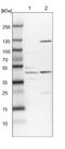 Spindlin Interactor And Repressor Of Chromatin Binding antibody, NBP1-81298, Novus Biologicals, Western Blot image 