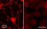Myosin-7B antibody, MP4551, ECM Biosciences, Immunocytochemistry image 
