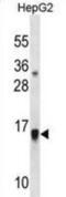 Glia Maturation Factor Beta antibody, abx031030, Abbexa, Western Blot image 