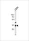 NK3 Homeobox 2 antibody, LS-C158396, Lifespan Biosciences, Western Blot image 