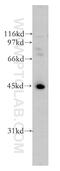 Ubiquitin Conjugating Enzyme E2 Q2 antibody, 12581-1-AP, Proteintech Group, Western Blot image 