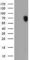 Ribosomal Protein S6 Kinase B1 antibody, TA502913, Origene, Western Blot image 