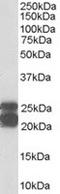Caveolin 1 antibody, TA302639, Origene, Western Blot image 