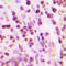 X-Ray Repair Cross Complementing 6 antibody, LS-C352232, Lifespan Biosciences, Immunohistochemistry paraffin image 