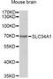 Solute Carrier Family 34 Member 1 antibody, A13634, ABclonal Technology, Western Blot image 
