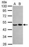 RNA-binding protein NOB1 antibody, GTX120935, GeneTex, Western Blot image 