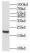 Myosin regulatory light chain 2, ventricular/cardiac muscle isoform antibody, FNab05519, FineTest, Western Blot image 