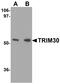 Tripartite motif-containing protein 30 antibody, A33062-1, Boster Biological Technology, Western Blot image 
