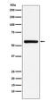 Serine/Threonine Kinase 33 antibody, M07375, Boster Biological Technology, Western Blot image 
