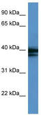 Heterogeneous nuclear ribonucleoprotein A/B antibody, TA345872, Origene, Western Blot image 