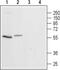 5-Hydroxytryptamine Receptor 3A antibody, PA5-77746, Invitrogen Antibodies, Western Blot image 