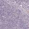 Smoothelin antibody, PA5-63590, Invitrogen Antibodies, Immunohistochemistry frozen image 