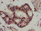 SPG21 Abhydrolase Domain Containing, Maspardin antibody, LS-C398025, Lifespan Biosciences, Immunohistochemistry paraffin image 