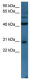 T Cell Leukemia Homeobox 2 antibody, TA345194, Origene, Western Blot image 