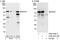 RIO Kinase 1 antibody, A302-457A, Bethyl Labs, Immunoprecipitation image 