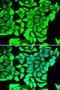 BLOC-1 Related Complex Subunit 7 antibody, A32251, Boster Biological Technology, Western Blot image 