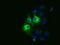 Cytochrome B5 Reductase 3 antibody, LS-C115374, Lifespan Biosciences, Immunofluorescence image 