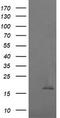 Cancer/Testis Antigen 1B antibody, TA505946BM, Origene, Western Blot image 