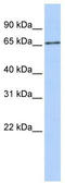 Solute Carrier Family 27 Member 6 antibody, TA334139, Origene, Western Blot image 