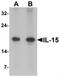 Interleukin-15 antibody, TA319665, Origene, Western Blot image 