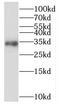 Mitochondrial Ribosomal Protein L15 antibody, FNab05318, FineTest, Western Blot image 