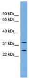 Zinc Finger RANBP2-Type Containing 2 antibody, TA344050, Origene, Western Blot image 