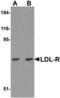 LDLR antibody, TA306778, Origene, Western Blot image 