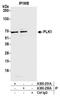 Polo Like Kinase 1 antibody, A300-250A, Bethyl Labs, Immunoprecipitation image 