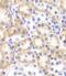 Serine Hydroxymethyltransferase 2 antibody, FNab07851, FineTest, Immunohistochemistry paraffin image 