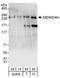 DENN Domain Containing 4A antibody, A303-255A, Bethyl Labs, Western Blot image 