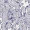 2,4-Dienoyl-CoA Reductase 1 antibody, HPA023160, Atlas Antibodies, Immunohistochemistry frozen image 