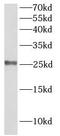 Claudin 5 antibody, FNab09967, FineTest, Western Blot image 