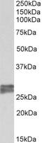 Troponin I, cardiac muscle antibody, TA348990, Origene, Western Blot image 