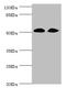 Zinc Finger C3HC-Type Containing 1 antibody, LS-C676731, Lifespan Biosciences, Western Blot image 