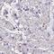 Calmodulin-like protein 3 antibody, NBP2-33434, Novus Biologicals, Immunohistochemistry frozen image 