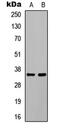 CCAAT Enhancer Binding Protein Beta antibody, abx121873, Abbexa, Western Blot image 