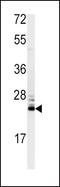 Methionine Sulfoxide Reductase A antibody, GTX81531, GeneTex, Western Blot image 