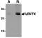 Homeobox protein VENTX antibody, LS-B5313, Lifespan Biosciences, Western Blot image 