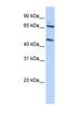 Solute Carrier Family 26 Member 10 antibody, NBP1-80393, Novus Biologicals, Western Blot image 