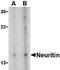 Neuritin 1 antibody, PA5-20368, Invitrogen Antibodies, Western Blot image 