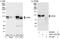 5'-3' Exoribonuclease 2 antibody, A301-102A, Bethyl Labs, Immunoprecipitation image 