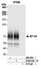 V-Set Domain Containing T Cell Activation Inhibitor 1 antibody, A700-043, Bethyl Labs, Immunoprecipitation image 