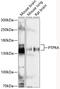 Protein Tyrosine Phosphatase Receptor Type A antibody, GTX66097, GeneTex, Western Blot image 