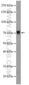 Zinc Finger Protein 606 antibody, 26128-1-AP, Proteintech Group, Western Blot image 