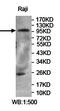 Membrane-associated phosphatidylinositol transfer protein 3 antibody, orb78147, Biorbyt, Western Blot image 