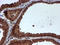 Histidyl-TRNA Synthetase 2, Mitochondrial antibody, LS-C173468, Lifespan Biosciences, Immunohistochemistry paraffin image 