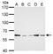 Gamma-Glutamyltransferase 1 antibody, TA308190, Origene, Western Blot image 