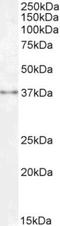Sprouty antibody, NBP1-51918, Novus Biologicals, Western Blot image 