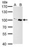 Importin 13 antibody, TA307937, Origene, Western Blot image 