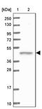 Vacuolar Protein Sorting 36 Homolog antibody, PA5-58905, Invitrogen Antibodies, Western Blot image 